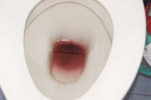 толкунданганда эркектерде тактар